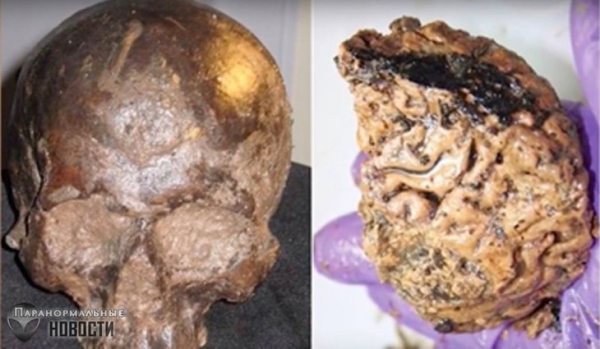 Странный феномен 2600-летнего окаменевшего человеческого мозга